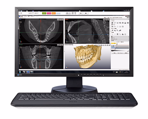 歯科用3Dイメージングソフトウェアを表示しているコンピュータモニター。