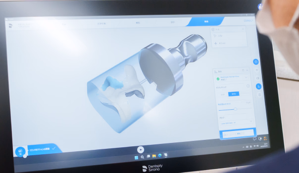 歯科補綴物を設計しているCADソフトの画面